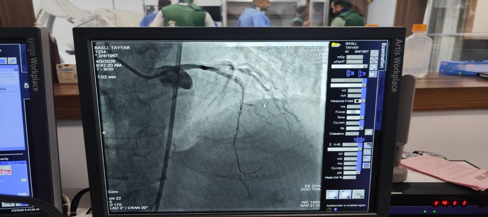 KÂHTA’DA AÇILAN ANJİYO ÜNİTESİNDE İLK HASTA BAŞARIYLA TEDAVİ EDİLDİ